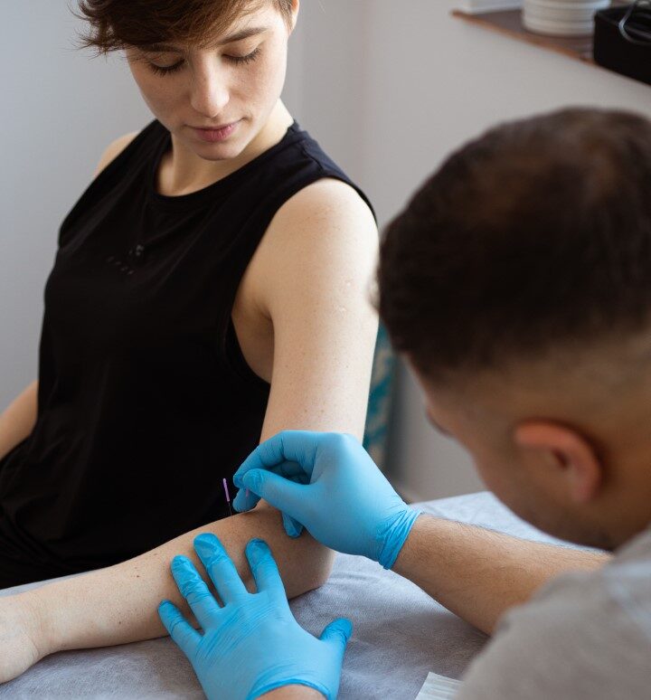 Zdjęcie — Suche igłowanie